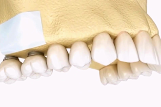 create 3d medical animation 3d medical explainer video 3d surgery animation