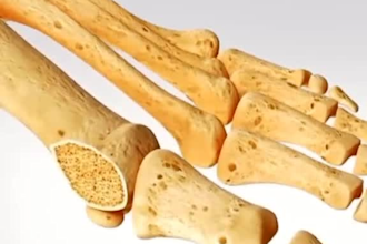 3d medical animation, surgery animation, 3d medical video from your script