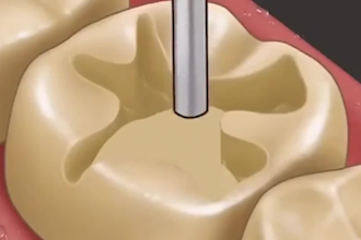 do 3d dental animation, dental video ads, 3d medical animation, healthcare video