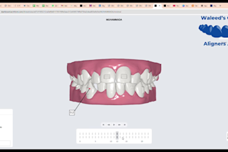 design orthodontic planning for clear aligner treatments
