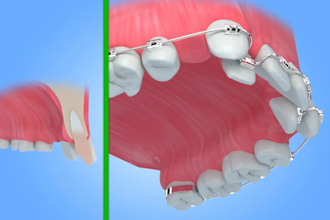 do high quality 3d medical animation modeling 3d dental teeth 3d product