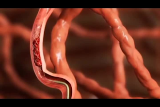 create quality eye catching 2d medical animation explainer healthcare video