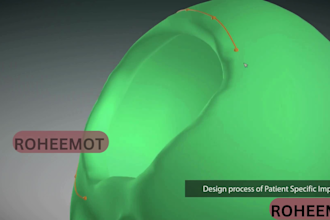 create 3d medical animation, surgical video, and medical device visuals