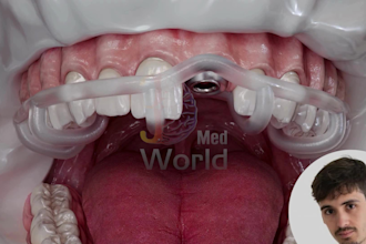 do 3d medical animation dental animation dental implant animation dental video