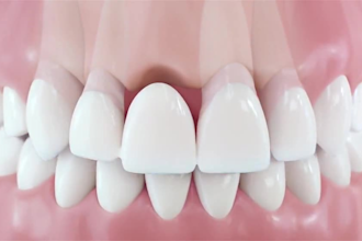 do high quality 3d dental animation 3d medical animation 3d product animation