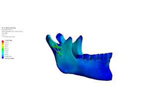 finite element analysis or superimpose ct xrays or mri scans