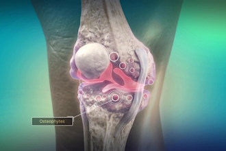 create a 3d medical animation video and a 3d anatomy animation explainer