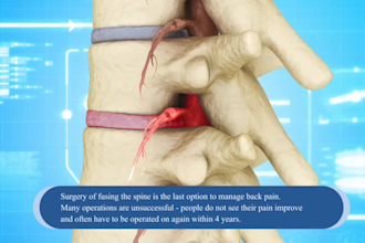 create 3d medical explainer video, 3d medical animation