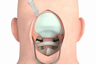 do 3d medical device animation 3d surgical device animation 3d medical explainer