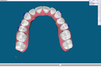 do dental clear aligner treatment planning on onyxceph, hit and 3shape analyzer