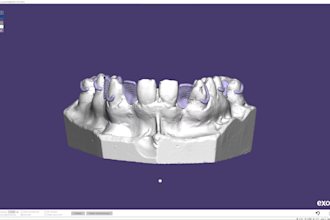 setup exocad 3,2 and partial cad software with guarantee