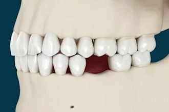 do 3d explainer video with high quality dental medical, health surgery animation