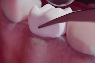 do 3d medical animation explainer videos dental animation character animation