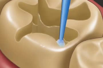 scientific animation, 3d dental animation, 3d medical animation, anatomy video