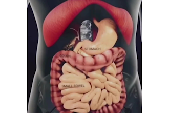 3d medical animation 3d medical device animation surgical device video 3d model