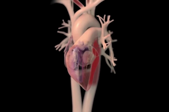3d cgi animation, 3d medical explainer video, 3d medical animation, surgerical
