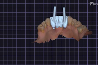 do digital crown designer specialized in exocad