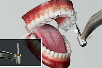 create 3d dental implant animation orthodontic explainer and dental device video