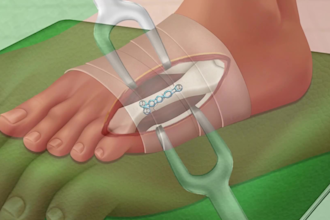 script, edit and animate medical and surgical videos