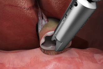 3d industrial animation medical animation mechanical animation product prototype