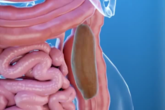 create 3d animation anatomy surgery animation 3d model 3d medical animation