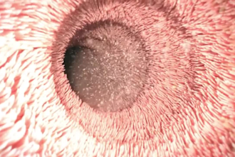 do 3d medical explainer, anatomy video, surgical animation and healthcare video