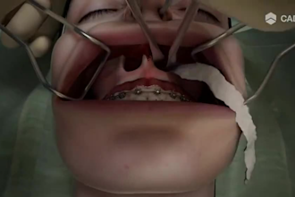 create high quality 3d dental animation, surgery explainer, and 3d medical video