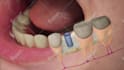 do dental animation in 3d
