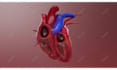 do high quality 3d medical animation and illustration