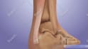 do 3d medical product and device animation