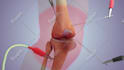 do 3d medical animation