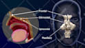 do high quality 3d medical animation and illustration