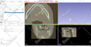 create medical 3d model from dicom, ct or mri images