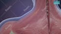 do 3d medical animation