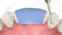 do high quality 3d medical animation