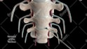 do surgery 3d animation