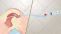 do 3d medical animation