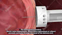 do 3d medical animation