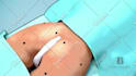 do high quality 3d medical animation and illustration