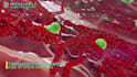 do high quality 3d medical animation and illustration