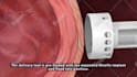 do 3d medical product and device animation