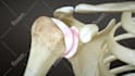 do high quality 3d medical animation and illustration