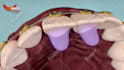 do dental animation in 3d
