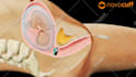 do the medical animation