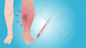 create medical or healthcare 2d animated explainer video