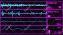 create a heart monitor music or audio visualizer horizontal or vertical