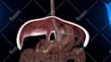create 3d medical explainer video, 3d medical animation