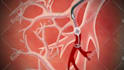 create 2d medical animations and explainer videos