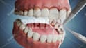 do 3d dental implant animation 3d abutmen crown explainer and surgery procedure