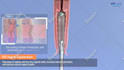 create 2d or 3d medical animations for you